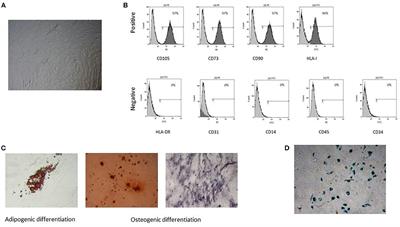 Proliferation Pattern of Pediatric Tumor-Derived Mesenchymal Stromal Cells and Role in Cancer Dormancy: A Perspective of Study for Surgical Strategy